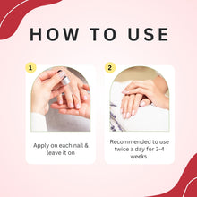Load image into Gallery viewer, Aroma Treasures Nail Care Oil (20ml)