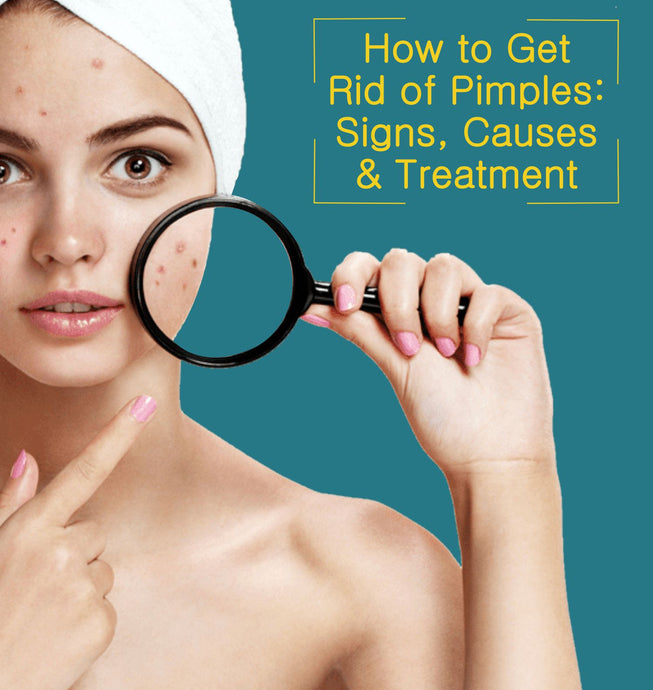 How to Get Rid of Pimples: Signs, Causes & Treatment