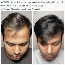 Load image into Gallery viewer, Aroma Treasures Hibiscus &amp; Bhringraj Scalp Rasa – Hair Tonic Spray for Hair Fall Control &amp; Stronger Hair (60 ml)